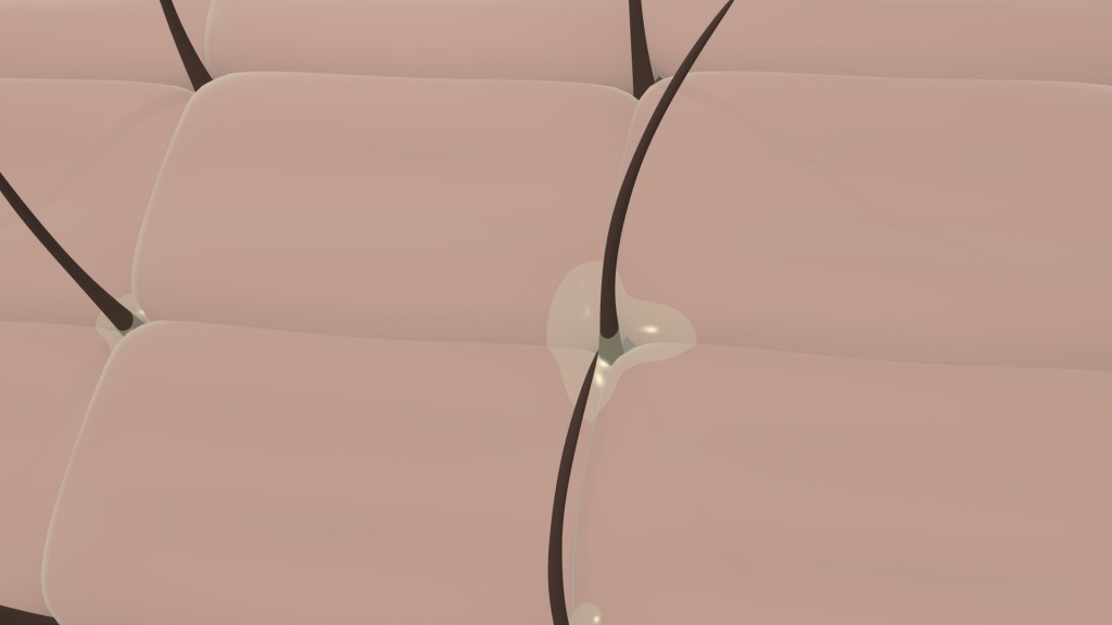 Skin cell-sebum on skin preview image 1